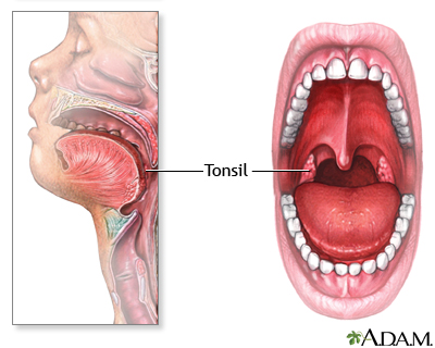 Tonsils+And+Adenoids Keep in mind that many doctors believe tonsils are removed more often ...